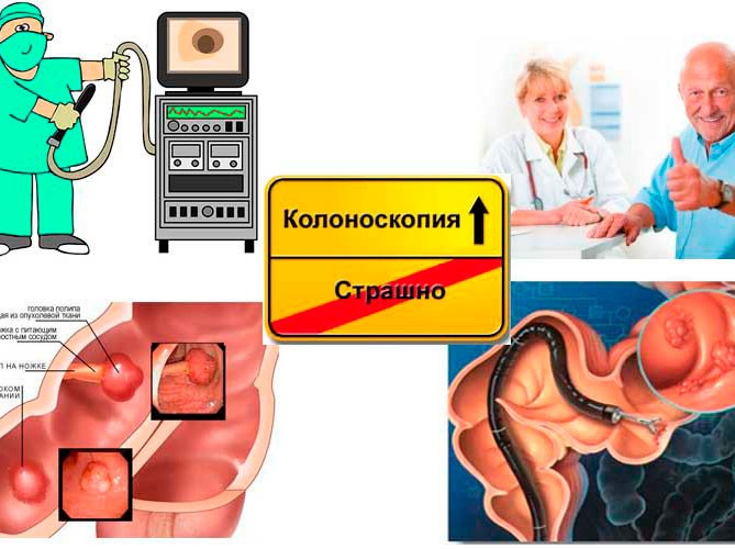 Колоноскопия В Витебске Под Наркозом Стоимость